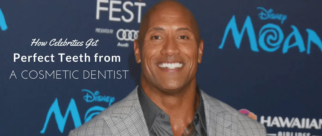 How celebrities get perfect teeth from a cosmetic dentist