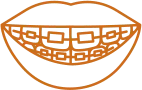 Self-Ligating Braces Adjustments in Peoria