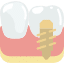 Tooth implant procedure near Phoenix 85024