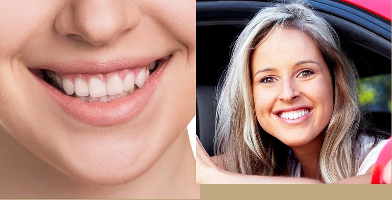Teeth Whitening Options in Glendale, AZ