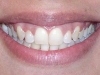 Orthodontic Disorder Cosmetic Dentist After