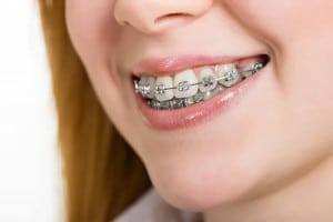 All About Orthodontics By Cosmetic Dentist Dr. Greg Ceyhan