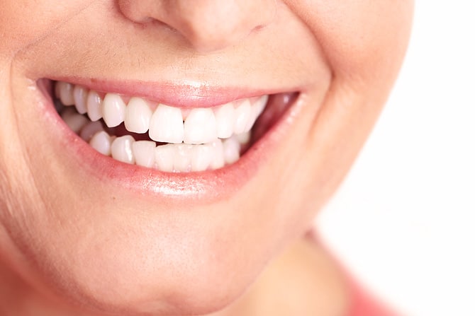 Beautiful porcelain veneer dental services in Arrowhead, Arizona