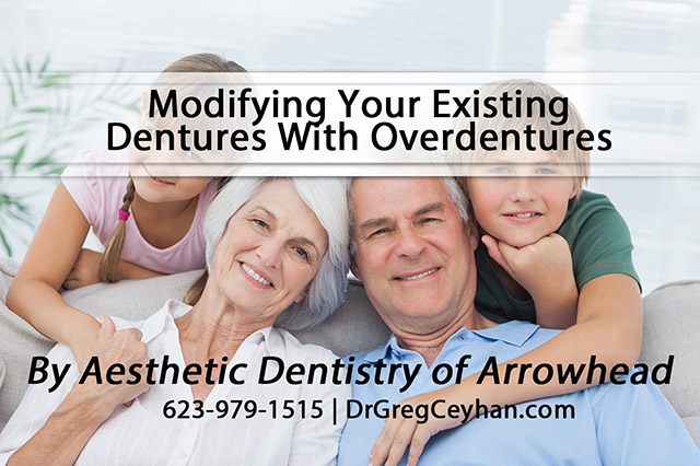 Modifying Your Existing Dentures With Overdentures