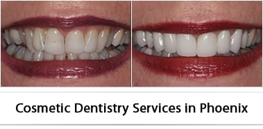 Expert Cosmetic Dentistry Services in Phoenix, Arizona