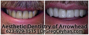 Top 5 Peoria AZ Cosmetic Dentistry Procedures