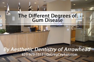 The Different Degrees of Gum Disease