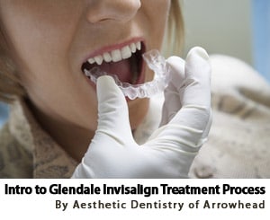 5 Step Guide To Invisalign Treatment Process in Glendale