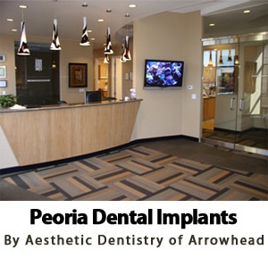 Expert Dental Implant Services by Aesthetic Dentistry in Peoria, AZ