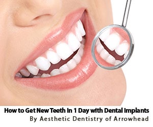 How to Get New Teeth in 1 Day with Glendale AZ Dental Implants