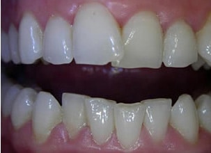 Female Patient Dental Transformation Before