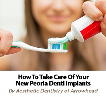 Find out how to properly care for your new Peoria dental implants!
