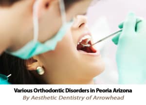 Learn about the various orthodontic disorders in Peoria AZ