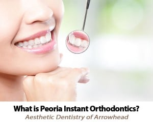 What Is Peoria AZ Instant Orthodontics?