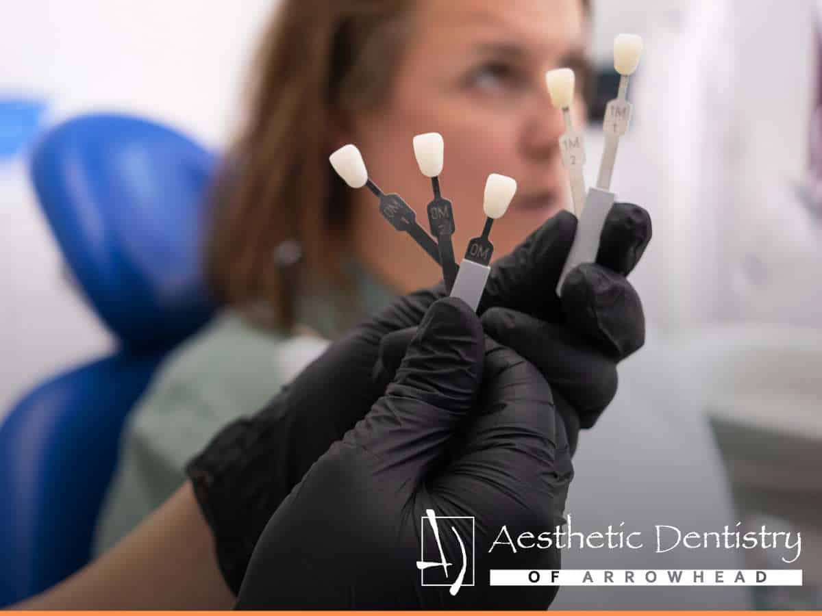 Dentist comparing shades for Porcelain Crowns