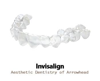 Straighten Your Teeth With Glendale Invisalign