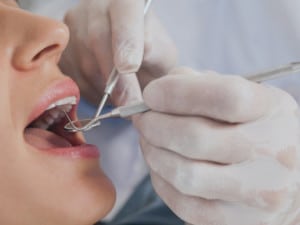 Apicoetomy Dentist in Glendale AZ
