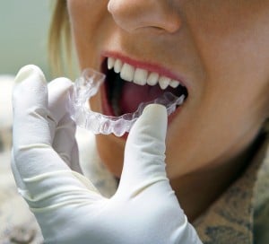Close-up of dentist's hand placing plastic braces