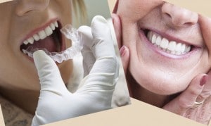 Glendale, AZ Orthodontic Services - Braces, Headgear