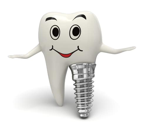 Why is my Glendale Dental Implant Failing and How to Prevent it?