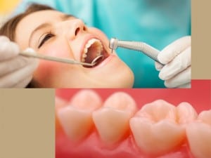 Periodontic Dentistry in Arizona
