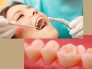 Periodontic Dentistry in Arizona