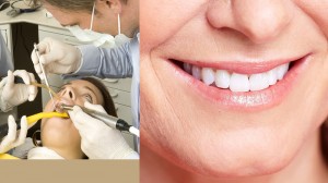 Professional Dental Cleanings in Glendale