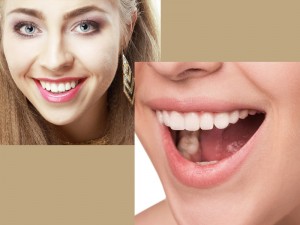 Zoom! Whitening In-Office teeth whitening services