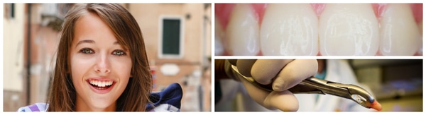 The Dental Implant Boom
