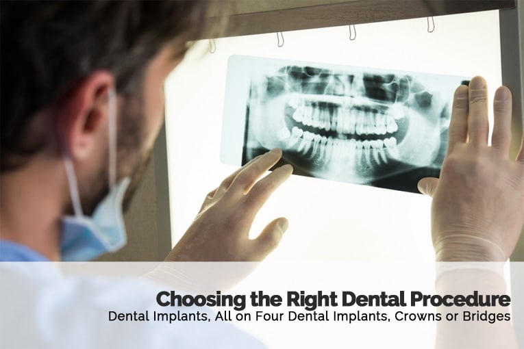 How To Choose The Right Dental Procedure in Glendale Arizona