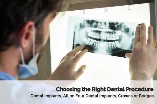 How To Choose The Right Dental Procedure in Glendale Arizona