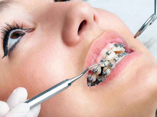 braces aesthetic dentistry
