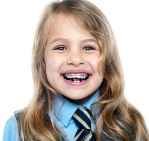 child braces