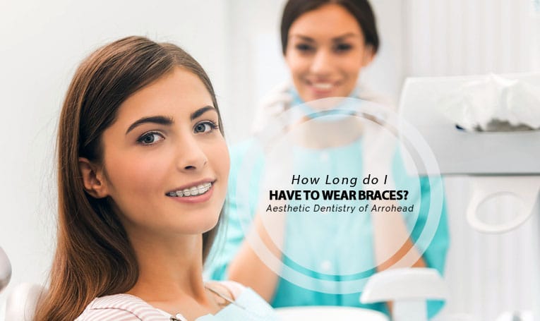 how long wear braces