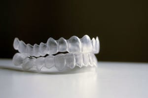 invisalign questions