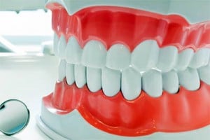 are dentures superior to dental implants