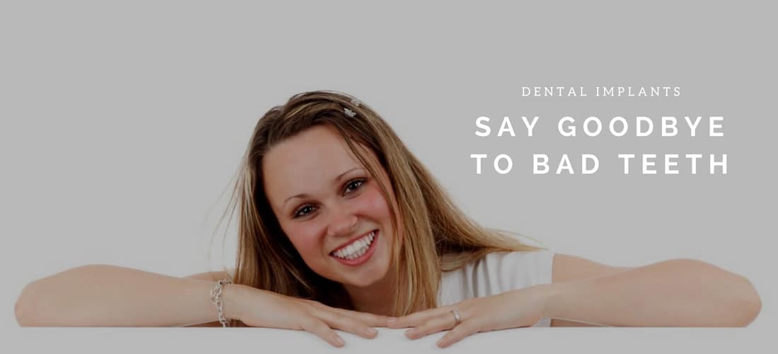 dental implants say goodbye to bad teeth