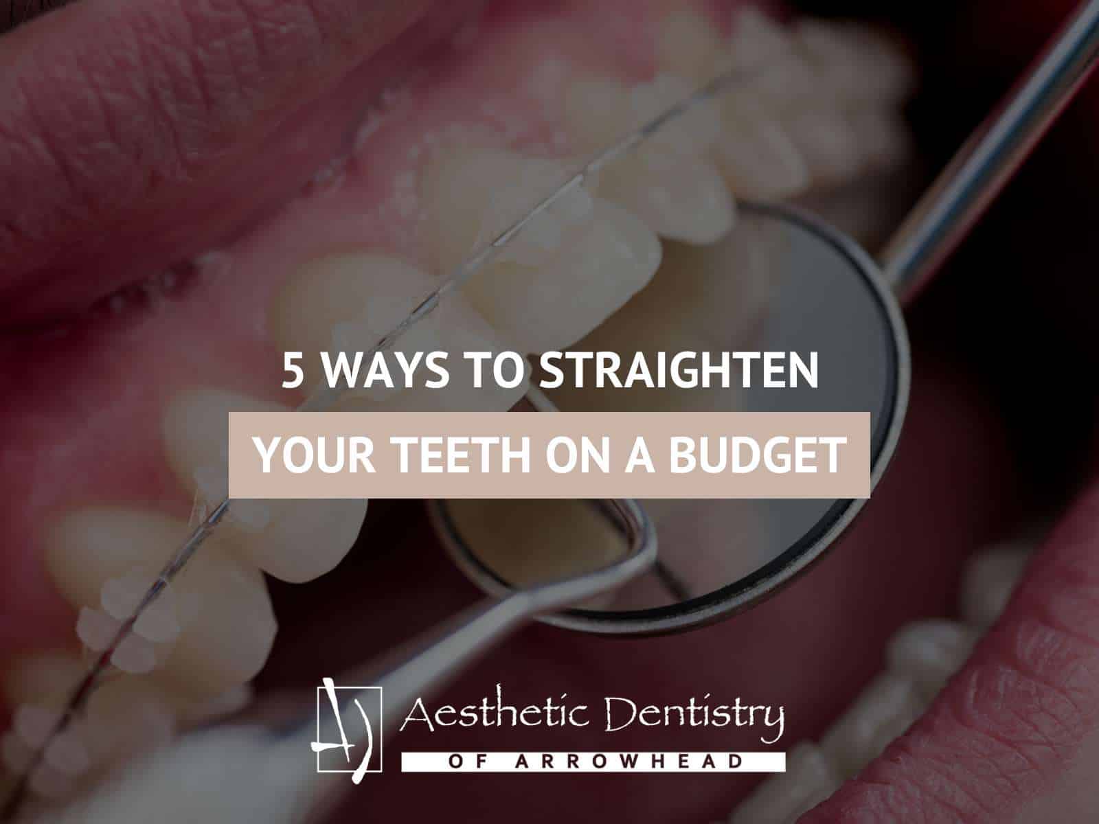 5 Ways To Straighten Your Teeth On A Budget