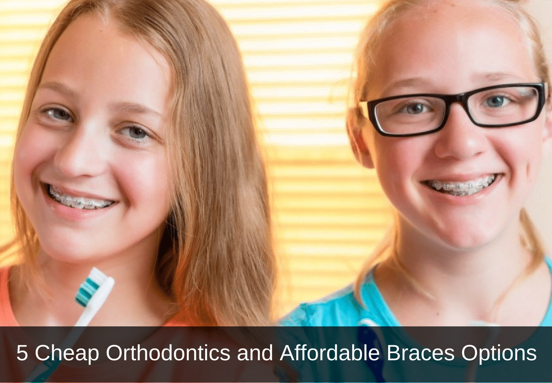 5 cheap orthodontics and affordable braces options