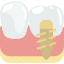 tooth implant procedure near phoenix 85024