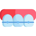 Ceramic braces