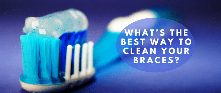 The Best Way to Clean Your Braces