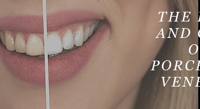 Women Smiling