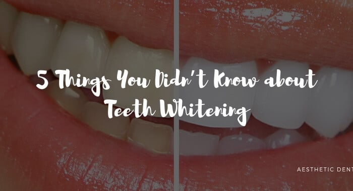 5 Things You Didn’t Know about Teeth Whitening