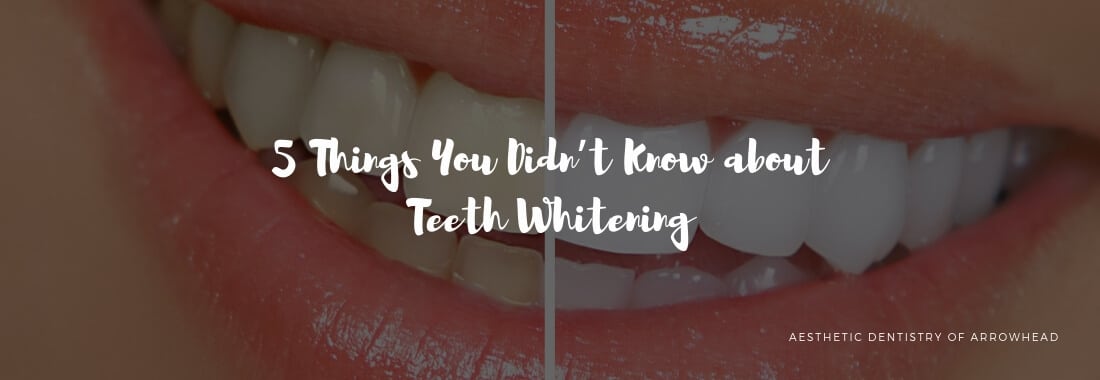 5 Things You Didn’t Know about Teeth Whitening