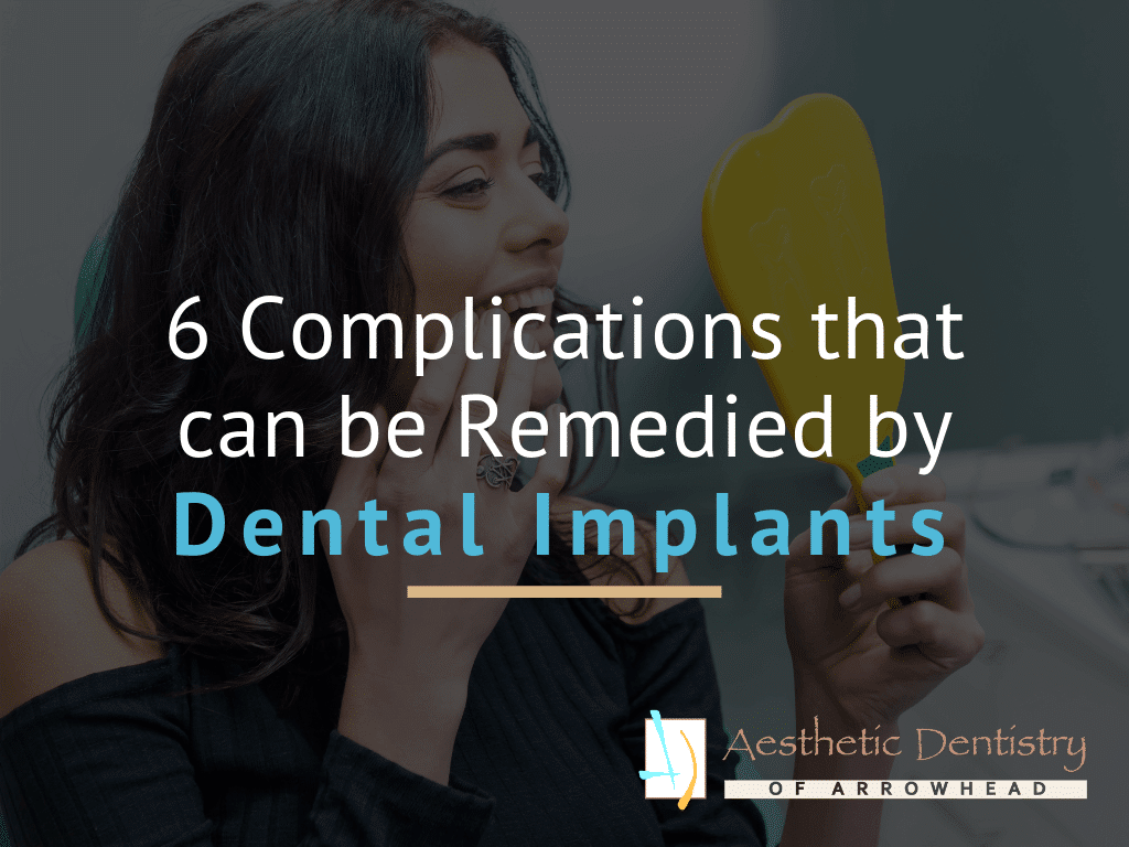 6 Complications that can be Remedied by Dental Implants