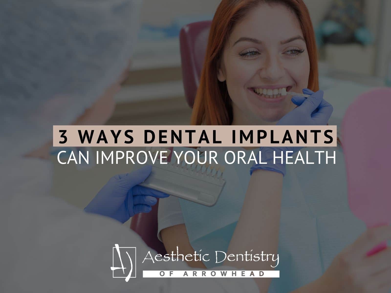 3 Ways Dental Implants Can Improve Your Oral Health