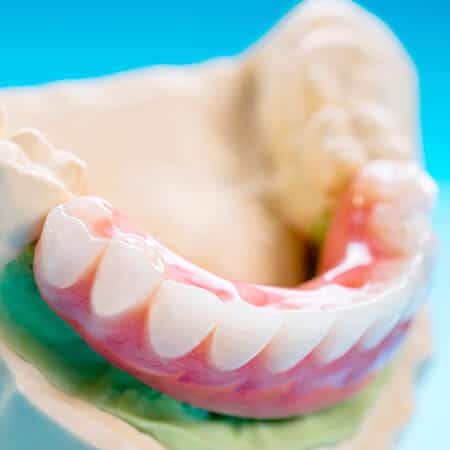 High Durability Glendale Dental Implants Near You
