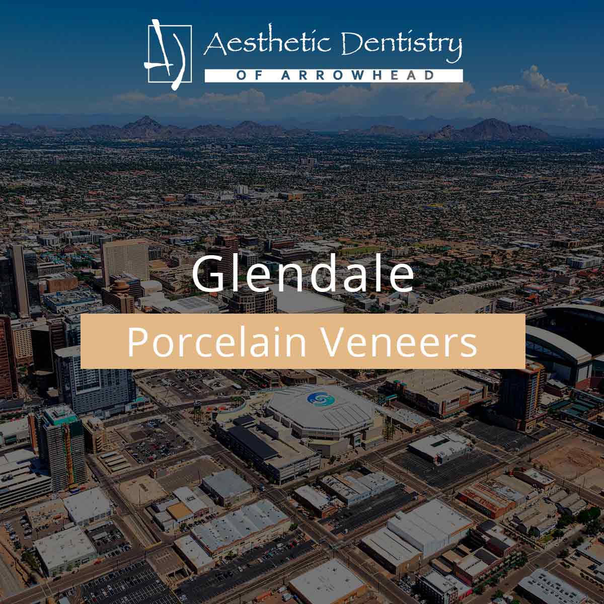 Glendale Porcelain Veneers featured image