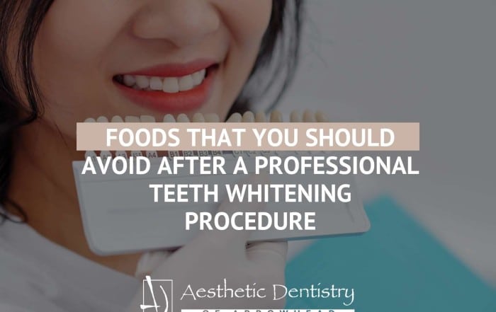 Foods That You Should Avoid After a Professional Teeth Whitening Procedure